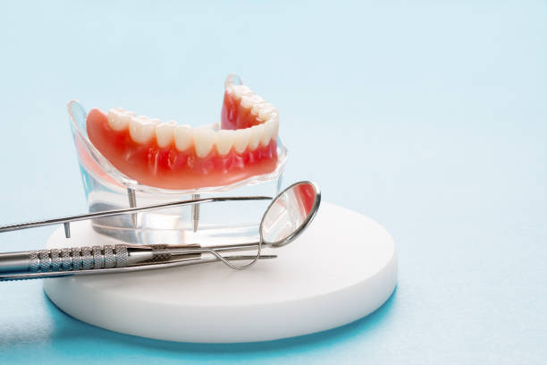Dental Inlays and Onlays in Charleston, MS